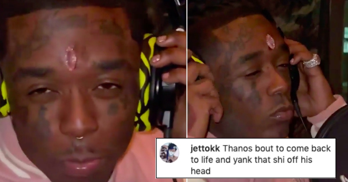 Lil Uzi Vert Got a Pink Diamond Implanted In His Forehead